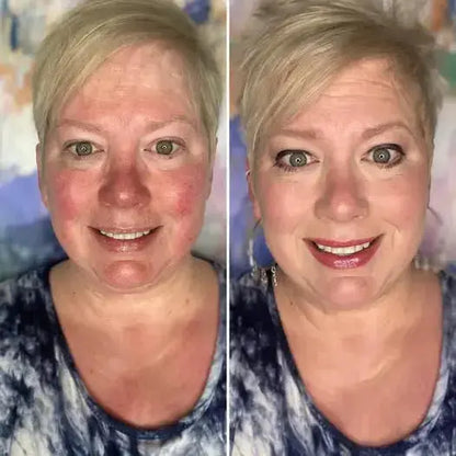 Ageless Skin Kit (+2 Free Gifts)